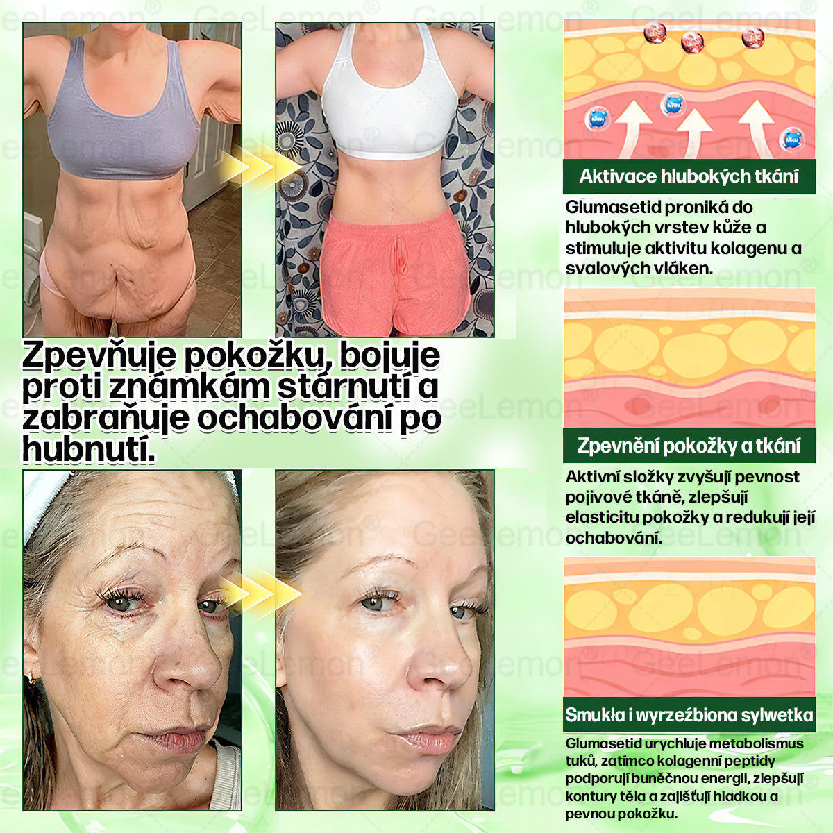 Doporučeno Fakultní nemocnicí Motol · 👩‍⚕️ Oficiální prodejna BENU | ✅ 𝐆𝐞𝑒𝑙𝑒𝐦𝐨𝐧® Glum𝐚𝐬𝐞tide 8 v 1 – Zeštíhlující nano mikrojihlový náplast 🇨🇿 Jen 1× denně ✅ Viditelné změny za 7 dní – na obezitu, kardiovaskulární zdraví, diabetes a kloubní problémy