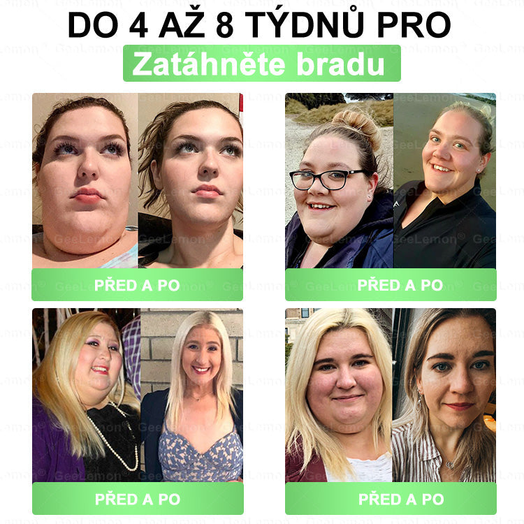 Doporučeno Fakultní nemocnicí Motol · 👩‍⚕️ Oficiální prodejna BENU | ✅ 𝐆𝐞𝑒𝑙𝑒𝐦𝐨𝐧® Glum𝐚𝐬𝐞tide 8 v 1 – Zeštíhlující nano mikrojihlový náplast 🇨🇿 Jen 1× denně ✅ Viditelné změny za 7 dní – na obezitu, kardiovaskulární zdraví, diabetes a kloubní problémy