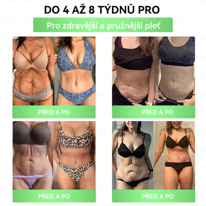 Doporučeno Fakultní nemocnicí Motol · 👩‍⚕️ Oficiální prodejna BENU | ✅ 𝐆𝐞𝑒𝑙𝑒𝐦𝐨𝐧® Glum𝐚𝐬𝐞tide 8 v 1 – Zeštíhlující nano mikrojihlový náplast 🇨🇿 Jen 1× denně ✅ Viditelné změny za 7 dní – na obezitu, kardiovaskulární zdraví, diabetes a kloubní problémy