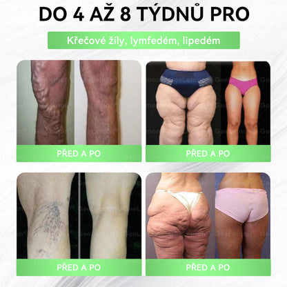 Doporučeno Fakultní nemocnicí Motol · 👩‍⚕️ Oficiální prodejna BENU | ✅ 𝐆𝐞𝑒𝑙𝑒𝐦𝐨𝐧® Glum𝐚𝐬𝐞tide 8 v 1 – Zeštíhlující nano mikrojihlový náplast 🇨🇿 Jen 1× denně ✅ Viditelné změny za 7 dní – na obezitu, kardiovaskulární zdraví, diabetes a kloubní problémy